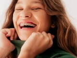 Kako priskrbeti ortodonta za otroka z napotnico?